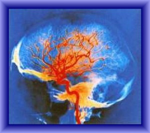 01-mozek-krev.jpg